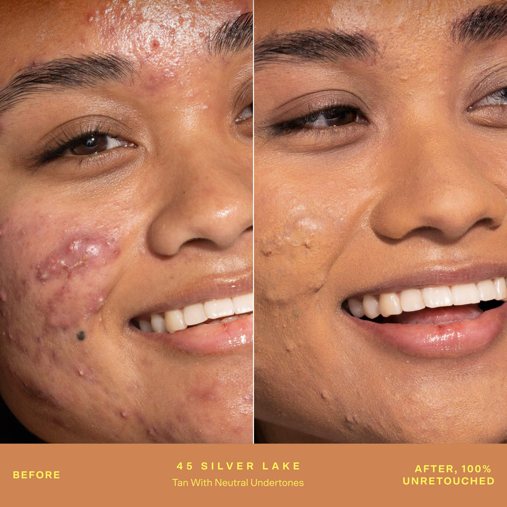 SunnyDays™ Tinted SPF 30 K2