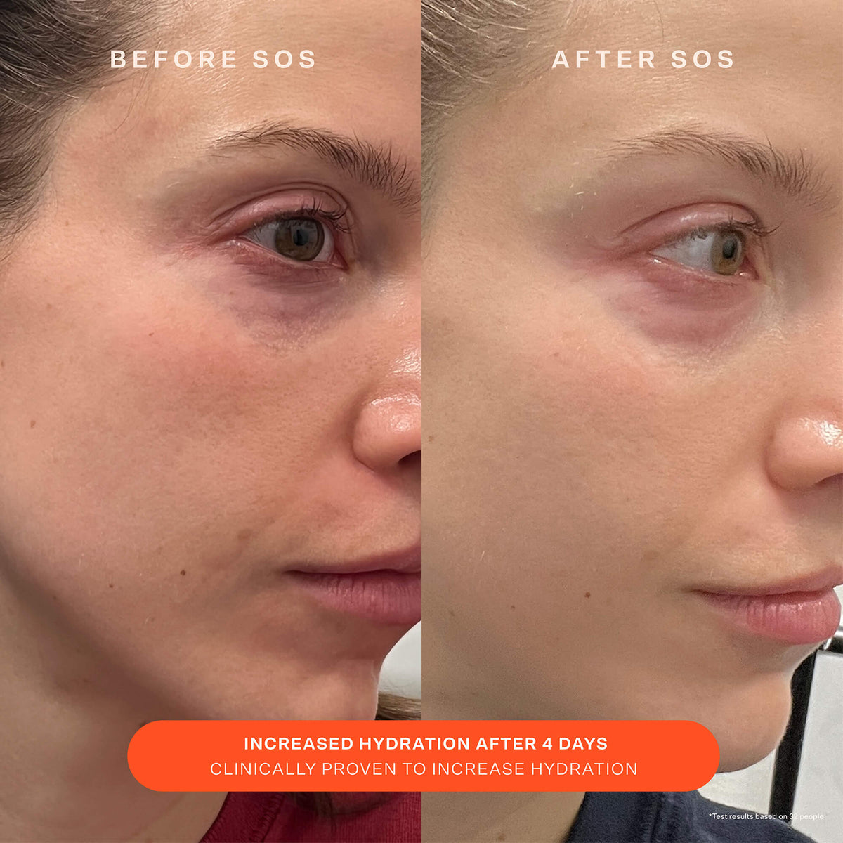 SOS Recovery Cream M9