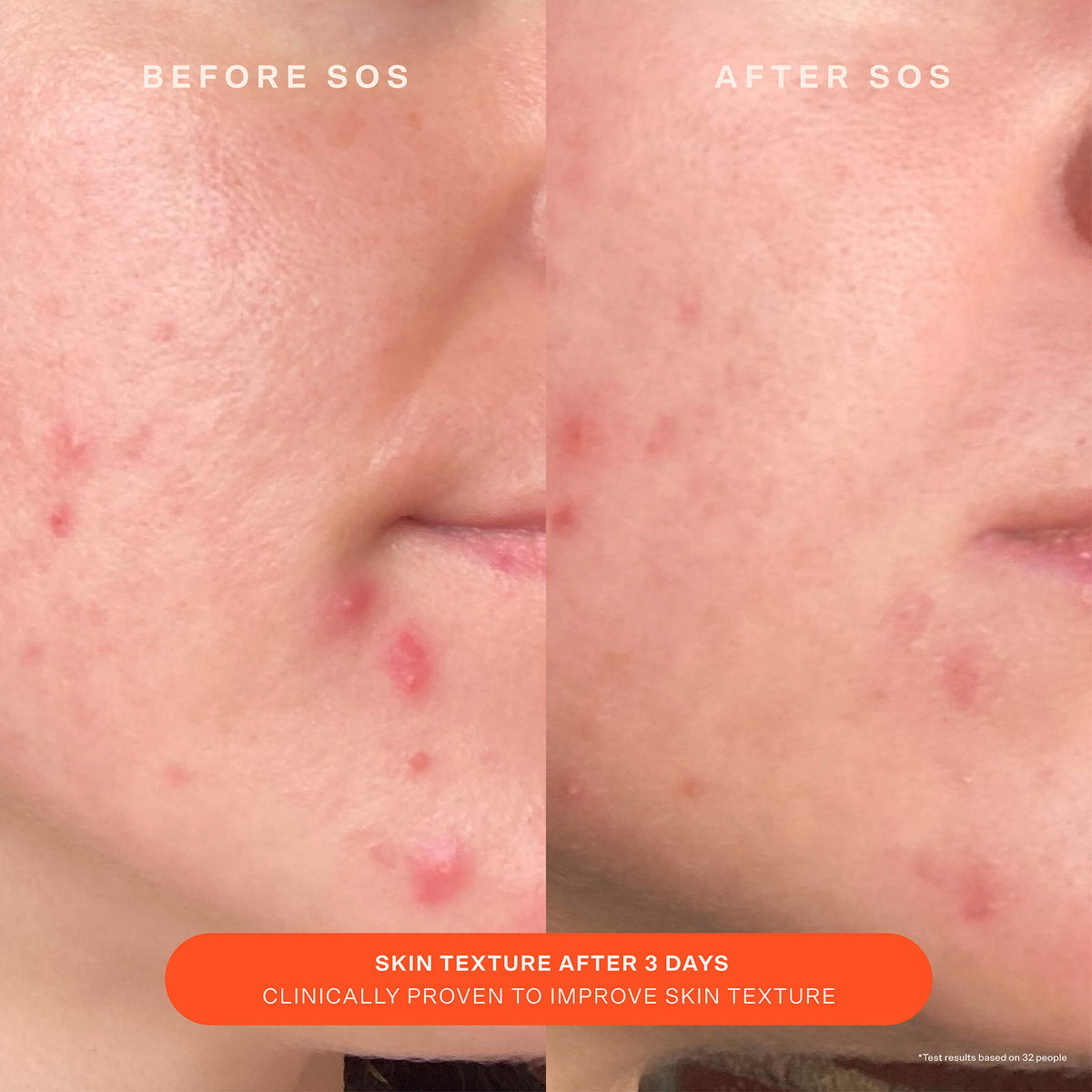 SOS Recovery Cream M9