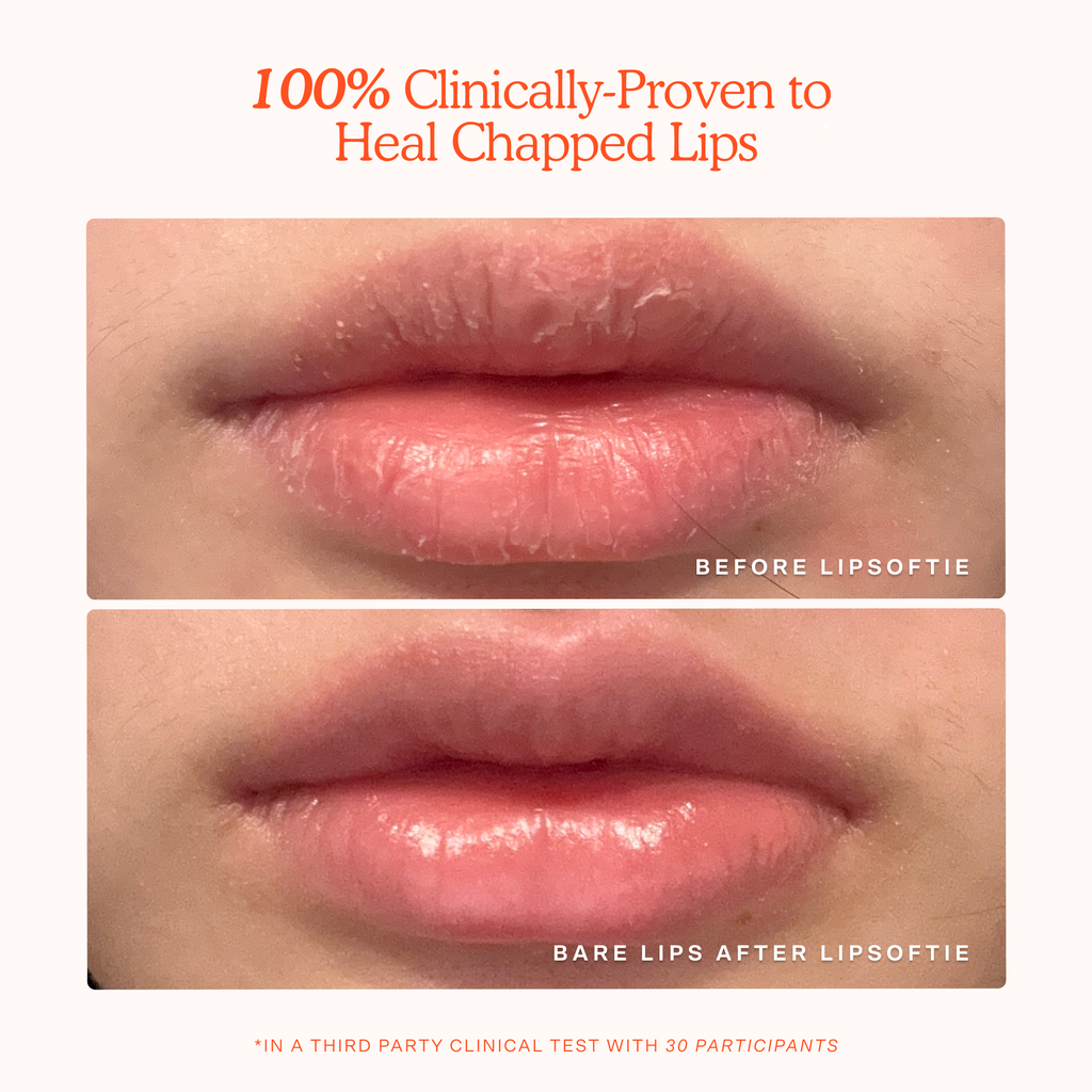 LipSoftie® Lip Treatment D6