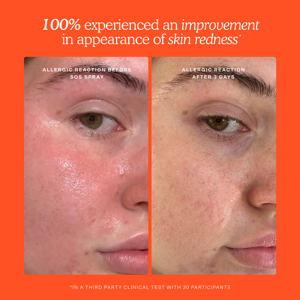 SOS Skincare Minis Kit R4