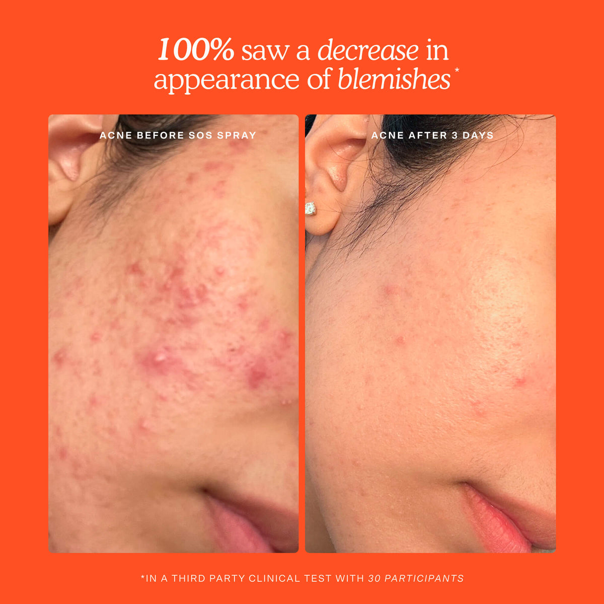 SOS 3-Step Skincare Set G5