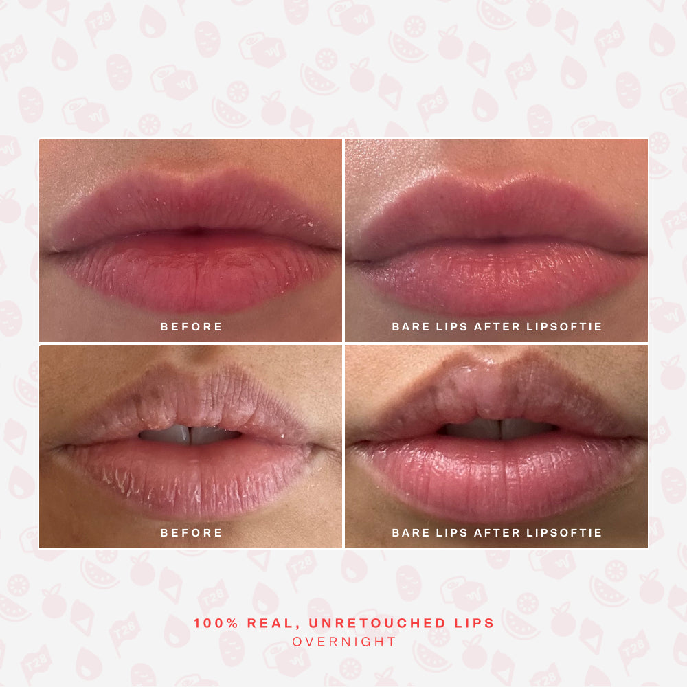 LipSoftie® Lip Treatment Set Q1