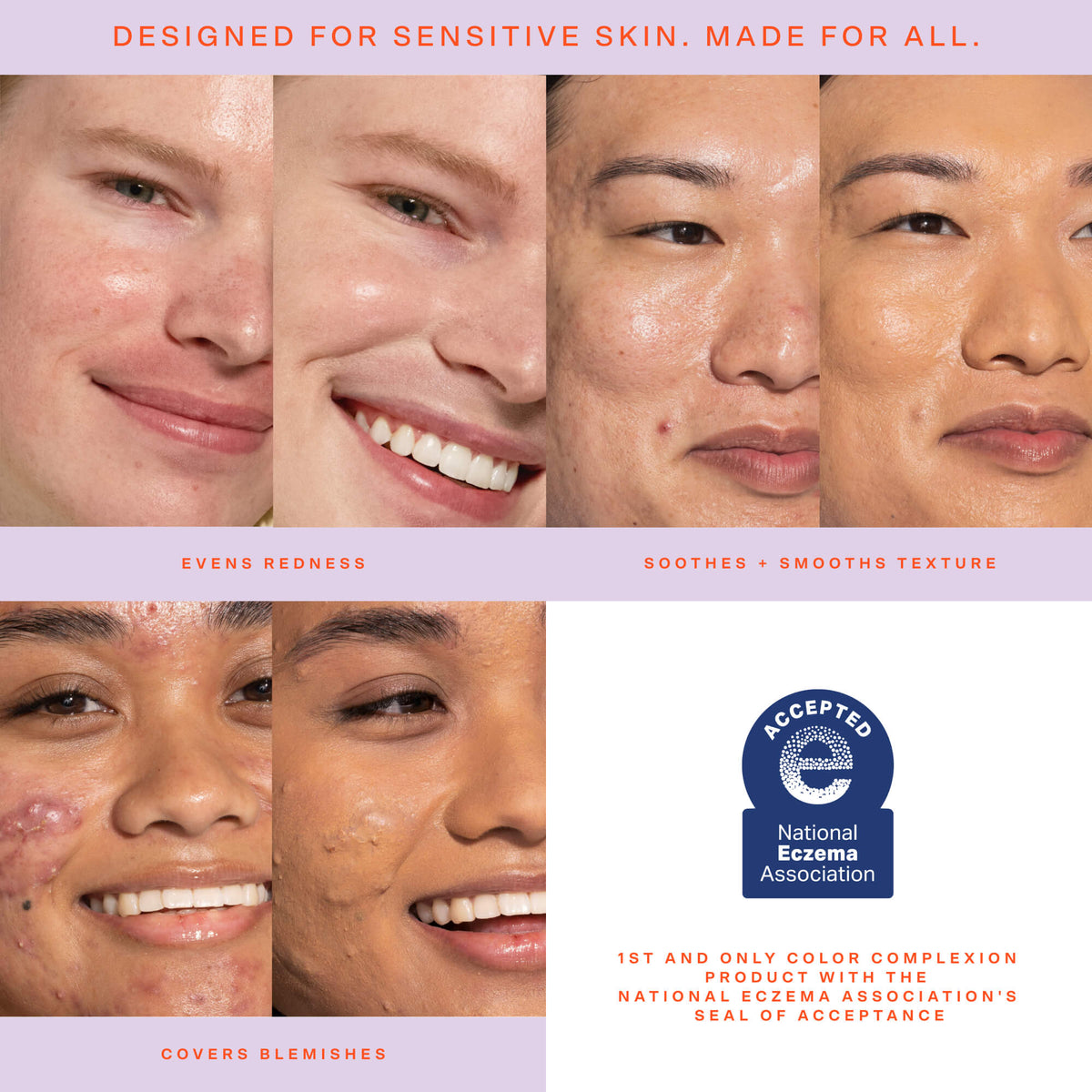 SunnyDays™ Tinted SPF 30 K2