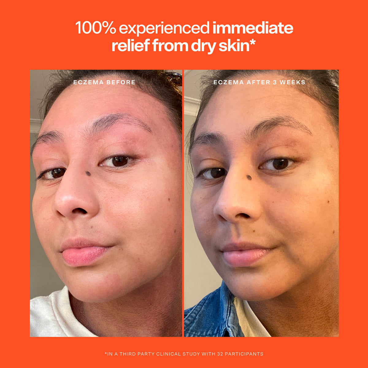 SOS Rescue Serum G8
