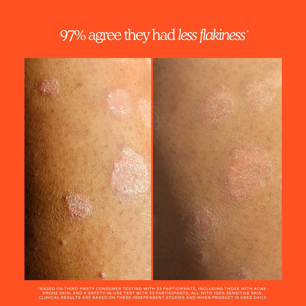 SOS Rescue + Relief Body Wash Treatment Z4