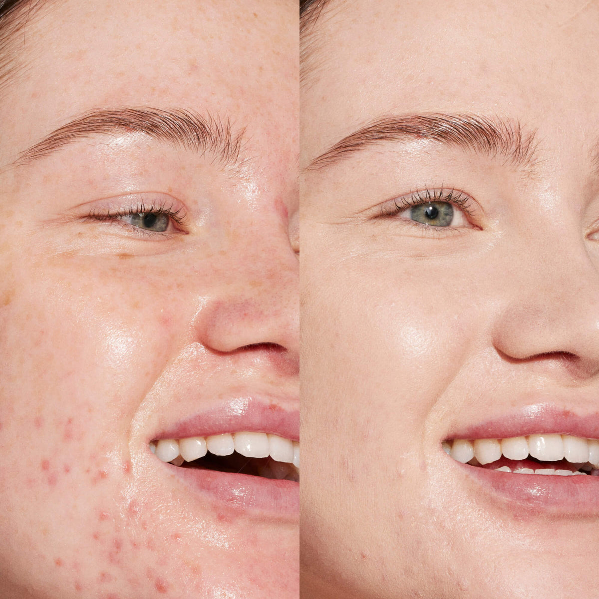 Swipe Serum Concealer® S0